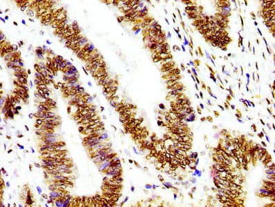 HIST1H3A Antibody