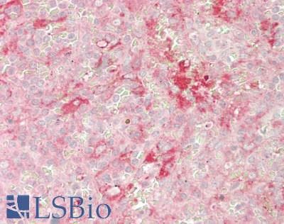 IHC-plus™ DHFR Antibody