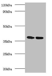 MTB Ag85A Antibody (aa53-331)