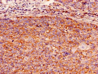 GBP2 Antibody