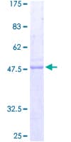 Human PRNP / PrP / Prion Protein (Recombinant GST)