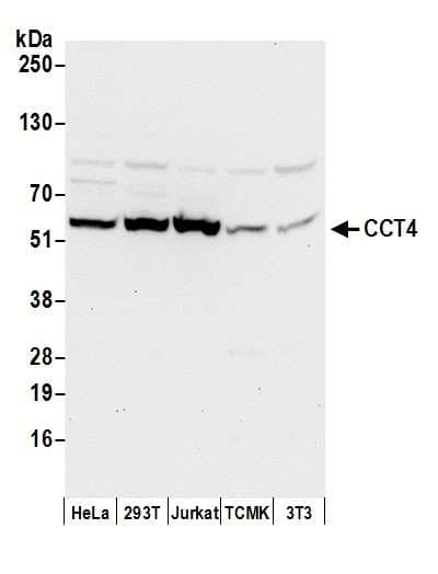 CCT4 / SRB Antibody (aa1-50)