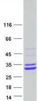 Human SCEH / ECHS1 Protein (Recombinant Myc-DDK (Flag))