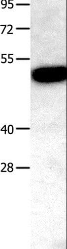 OPG / Osteoprotegerin Antibody