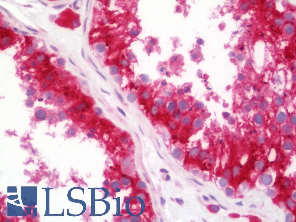 IHC-plus™ Polyclonal Rabbit anti-Human PRAF2 Antibody (aa141-190, IHC, IF, WB)