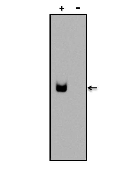 Digoxin Antibody (clone 26G10)