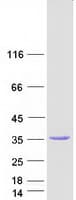 Human MPST Protein (Recombinant Myc-DDK (Flag))