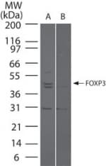 FOXP3 Antibody