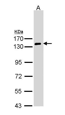 Polyclonal Rabbit anti-Human NPRA / NPR1 Antibody (WB)