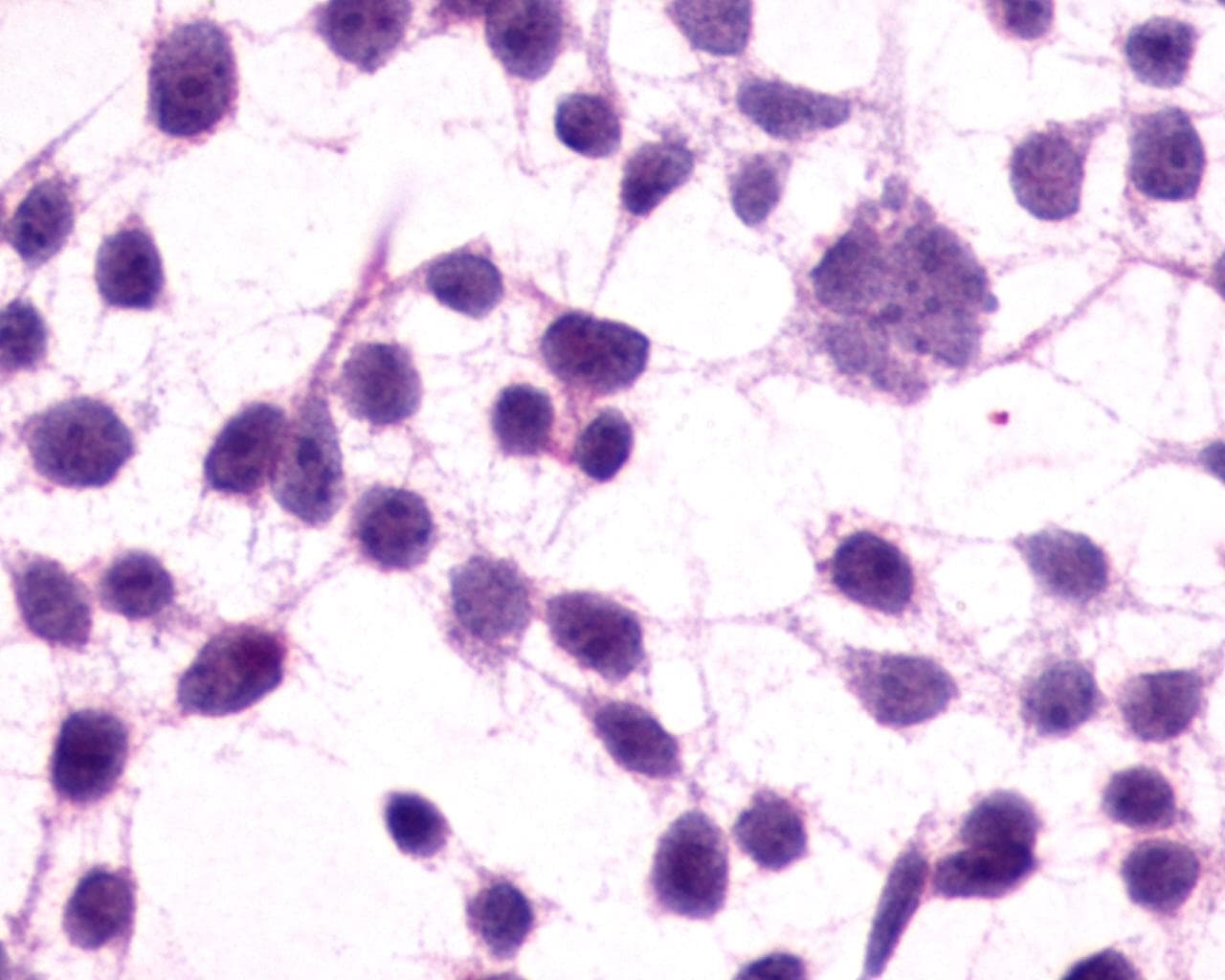 PathPlus™ GRM3 / MGLUR3 Antibody (N-Terminus)