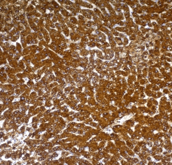 Hepatocyte Specific Antigen Antibody (clone OCH1E5, Ready-to-Use)