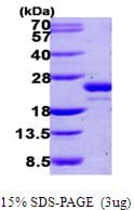 Human UFC1 Protein (Recombinant His)