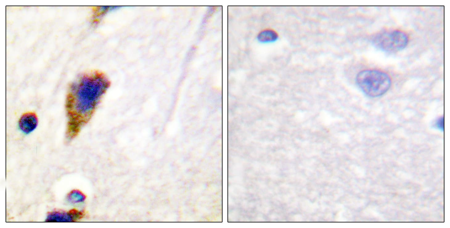 DNM1 / Dynamin Antibody (aa740-789)
