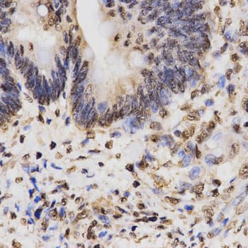 Histone H3 Antibody (Trimethyl-Lys27)