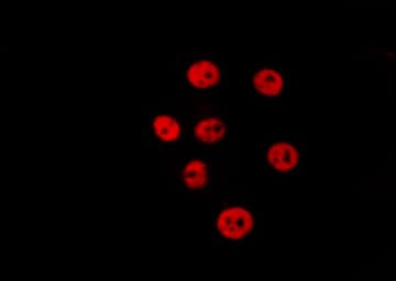 STAT1 Antibody (phospho-Ser727)