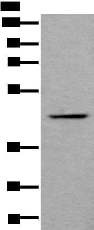 BMP2 Antibody