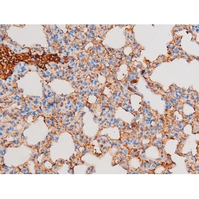 PRKCQ / PKC-Theta Antibody (phospho-Ser676)
