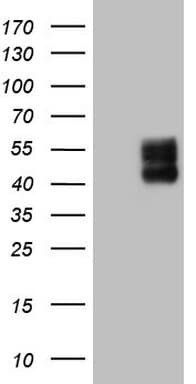 IHC-plus™ Monoclonal Mouse anti-Human PDCD1 / CD279 / PD-1 Antibody (clone 2F6, IHC, IF, WB)