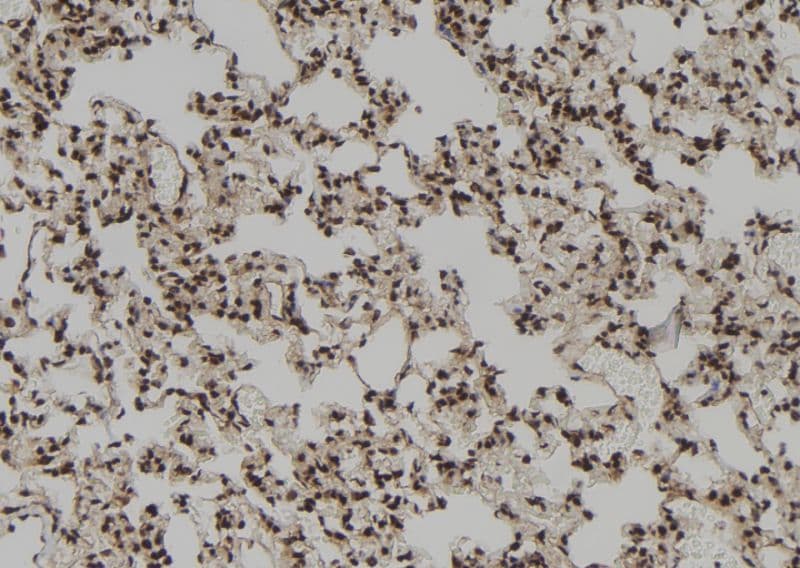 RNASEH1 Antibody