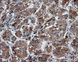 PTPRE / PTP Epsilon Antibody (clone OTI3H8)