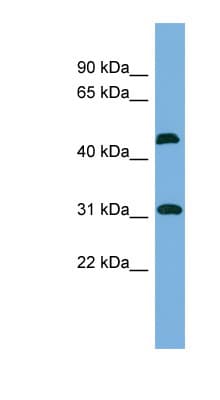CTDSP2 Antibody (N-Terminus)