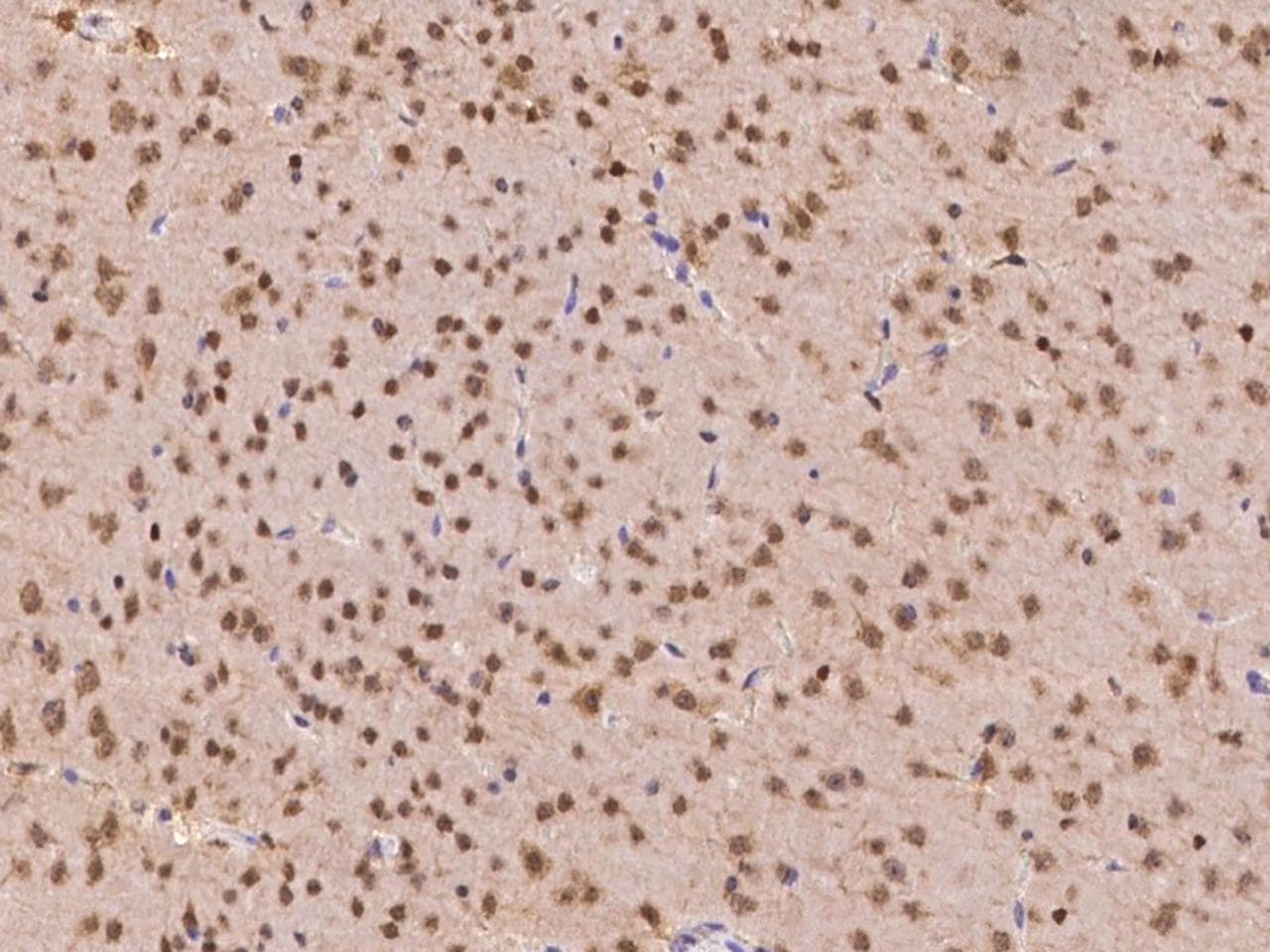 PTPN2 / TC-PTP Antibody (Preservative Free)