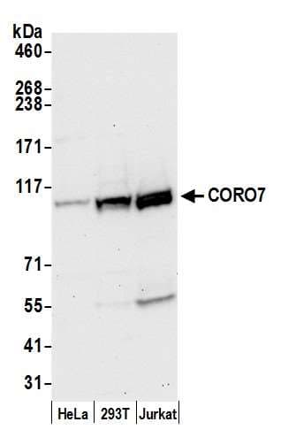 Coronin 7 / CORO7 Antibody (aa400-450)