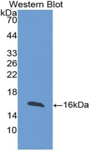 Polyclonal Rabbit anti-Human FABP4 / AP2 Antibody (aa2-132, WB)