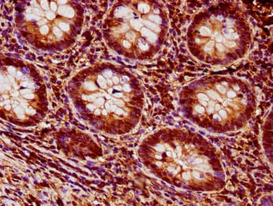 HIST1H1E Antibody