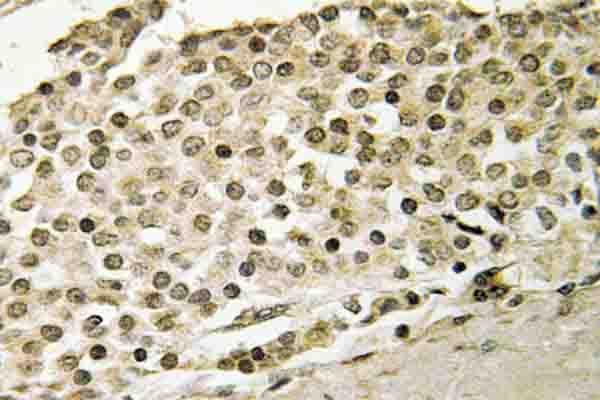 Polyclonal Rabbit anti-Human RRP8 Antibody (Leu310, IHC, WB)