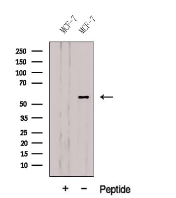 CBLL1 / HAKAI Antibody
