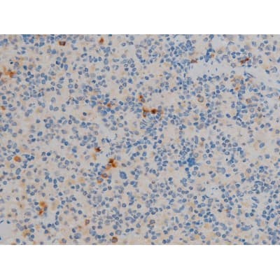 Polyclonal Rabbit anti-Human BCL2 / Bcl-2 Antibody (phospho-Ser70, IHC, IF, WB)