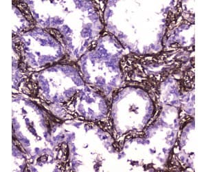 Polyclonal Rabbit anti-Human ANXA6/Annexin A6/Annexin VI Antibody (IHC, WB)