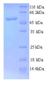 Human MYCN / N-myc Protein (Recombinant His)