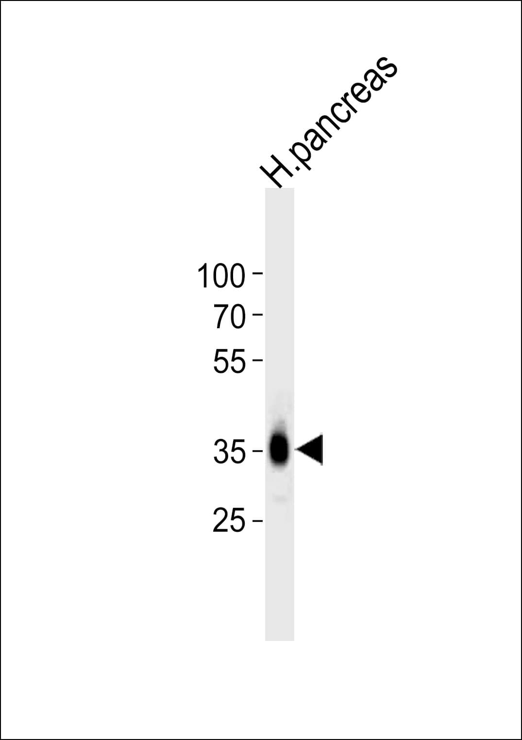 IHC-plus™ Polyclonal Rabbit anti-Human PAP2a / PPAP2A Antibody (aa270-304, IHC, WB)