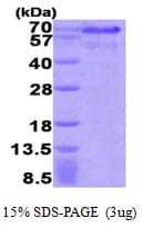 Human HEXIM1 Protein (Recombinant His)