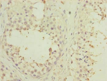 PDHA2 / PDH E1 Beta Antibody