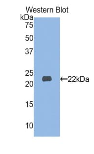 MYL3 Antibody (aa5-181)