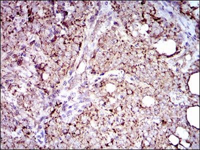 Monoclonal Mouse anti-Human ALDH2 Antibody (clone 4G6A3, Amino Acid: 317-517, IHC, IF, WB)