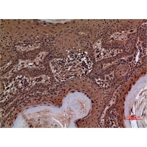 Alpha-1-Antichymotrypsin Antibody (251-300 aa, Internal)
