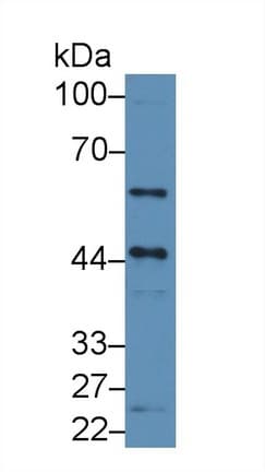 CX3CL1 / Fractalkine Antibody (aa81-336)