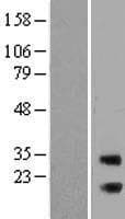 RAB3IP / RABIN3 Protein (Over-Expression Lysate Myc-DDK (Flag))
