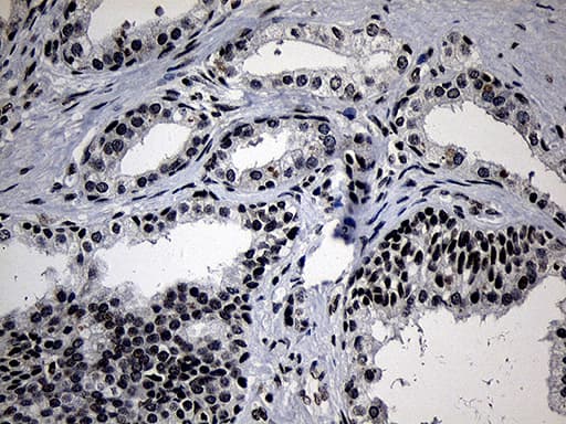 ELL / MEN Antibody (aa302-621, clone OTI2H7)
