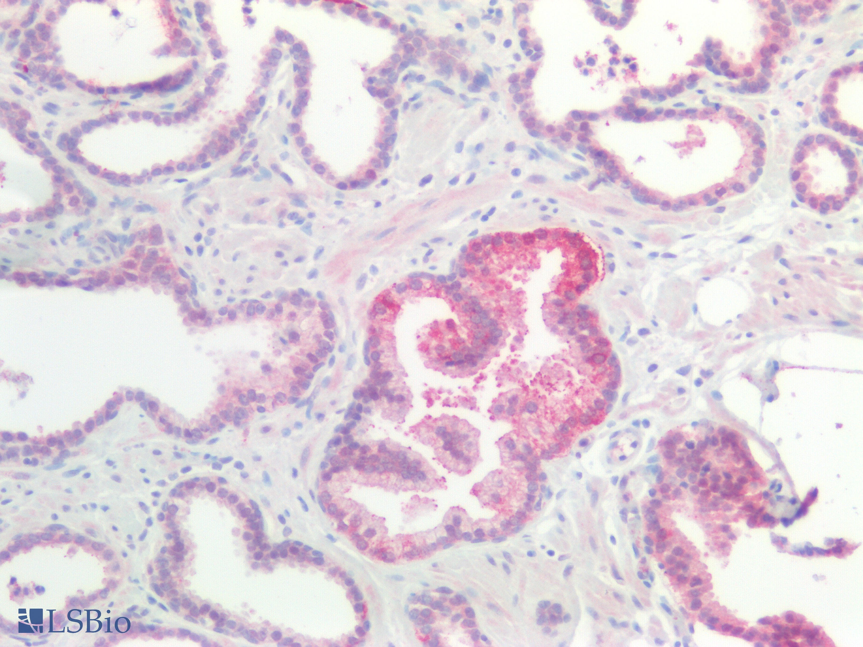 PathPlus™ Polyclonal Rabbit anti-Mouse CTNNBIP1 / ICAT Antibody (aa1-81, IHC, WB)