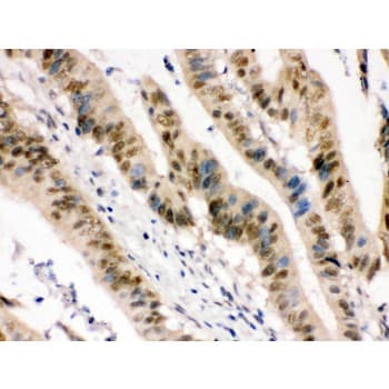 Polyclonal Rabbit anti-Human ZBTB7A / Pokemon Antibody (aa125-163, IHC, WB)