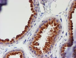 MEF2C Antibody (clone OTI2F2)