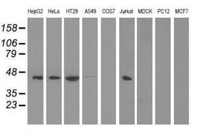 PAICS / ADE2 Antibody (clone OTI8A1)