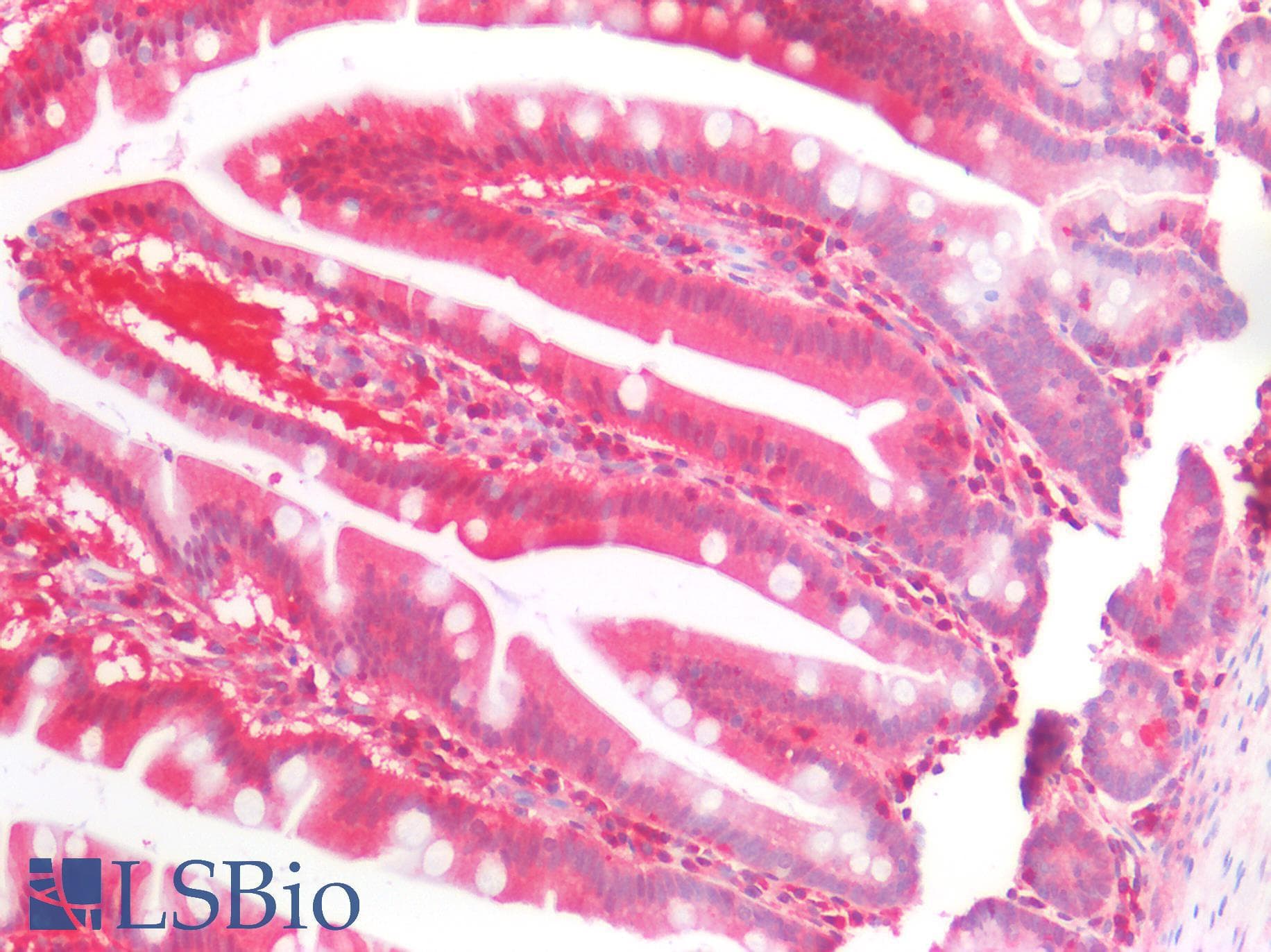 IHC-plus™ Polyclonal Rabbit anti-Human GABARAPL2 / ATG8 Antibody (IHC, IF, WB)