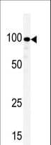 KSR1 Antibody (aa159-194)