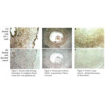 Monoclonal Mouse anti-Human PTHR / PTHR1 Antibody (clone 3D1.1, IHC, WB)